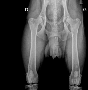 Radiographie des hanches